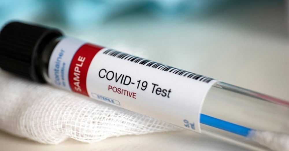 El Ejecutivo local detalló que desde el inicio de la pandemia, 18 personas fueron diagnosticadas con Covid-19.